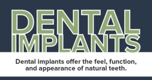 Dental Implants infographic preview